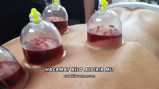 Hacamat Kilo Aldırır mı?