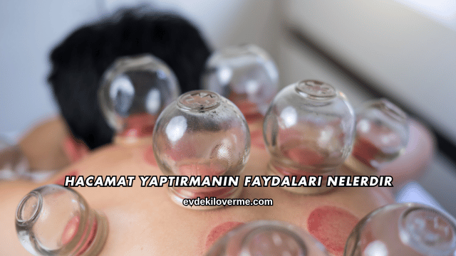Hacamat Yaptırmanın Faydaları Nelerdir
