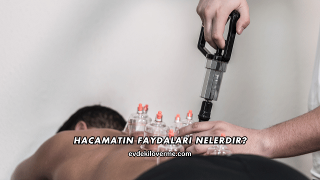Hacamatın Faydaları Nelerdir?